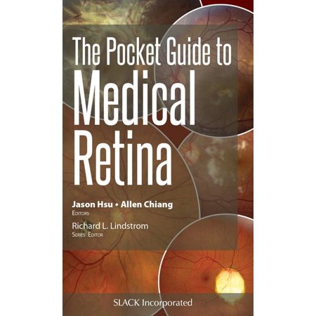 UPC: 9781630916329 | Pocket Guides: The Pocket Guide to Medical Retina (Paperback)