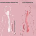 thumbnail image 5 of Almohada camilla para aliviar el dolor de espalda, soporte lumbar, hernia de disco, alivio del dolor de ciática, corrector de postura, rosa, 5 of 5