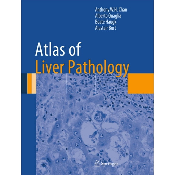 Atlas of Anatomic Pathology Atlas of Liver Pathology, (Hardcover)
