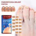 thumbnail image 4 of The New Inlay Box Groove Corrector Toenails Long Meat In The Nail Device Roll Nail Inlaid Nail Correction Tool Fff, 4 of 5