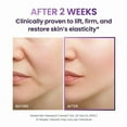 thumbnail image 4 of BIOHEAL BOH Probioderm Ensemble de Soins Lifting 3D, 4 of 8