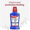 thumbnail image 1 of Colgate Peroxyl Bain de Bouche pour Escarres - 1,5 % Peroxyde d'Hydrogène, Saveur Menthe, 237 ml - Opti Rinse Bain de Bouche pour Traitement des Escarres et Liquide de Bain de Bouche, 1 of 4
