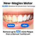 thumbnail image 3 of Marlincare Sonic Electric Toothbrush for Adults,Rechargeable Powered Toothbrush,180-Day Battery, 12x Plaque Removal,IPX8 Waterproof, Black, 3 of 11