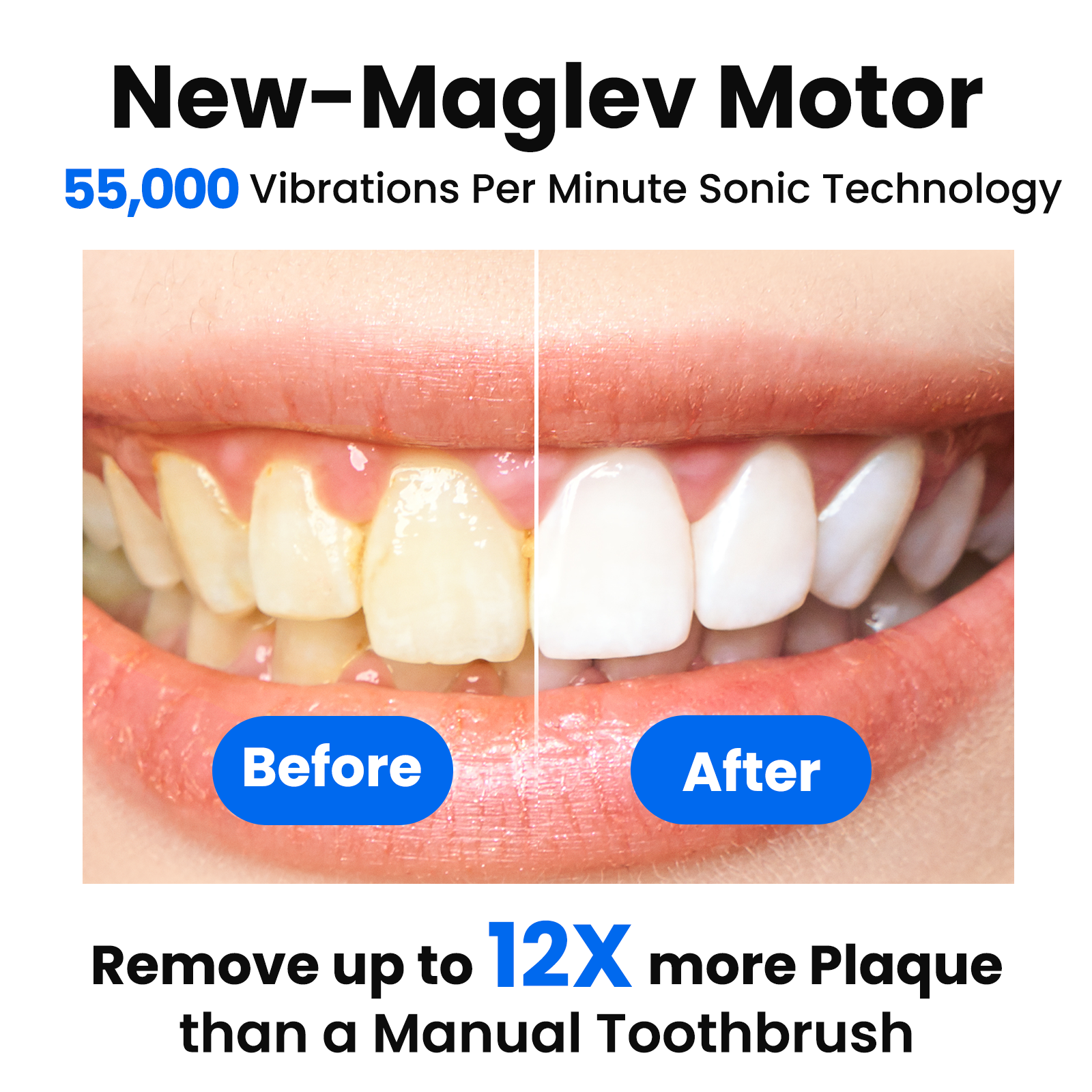 Marlincare M10PRO Sonic Electric Toothbrush, 180-Day photo 2