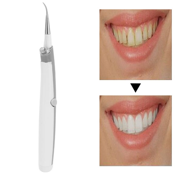 Hilitand Tooth Cleaner,Tooth Cleaner Electric Portable Tooth Cleaning Tool For Removing Stains Plaque Tartar Coffee Stains,Portable Tooth Cleaner