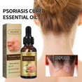 thumbnail image 2 of Coconut oil Essential oils Skin Moss Oil Skin Itching, Stop Itching, Swelling, Hand And Foot Moss External Care Oil（30ml） Essential(buy 2 get 10% off), 2 of 5