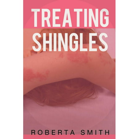 Treating Shingles - eBook