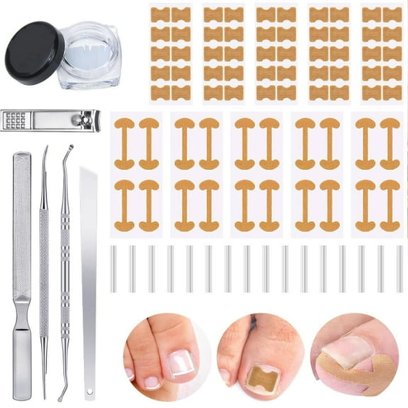 Professional Ingrown Toenail Set with Breathable Ingrown Toenail Strips, Curved Toenails Corrector Patch, Painless File and Lifter Pedicure Tools