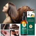 thumbnail image 1 of Fiudx Aceite Capilar de Jengibre, Líquido Nutritivo Reparador de Folículos, Potenciador Del Crecimiento Capilar, Tratamiento Hidratante para El Cuero Cabelludo, Prevención de La Caída Del Cabello, Cu, 1 of 6