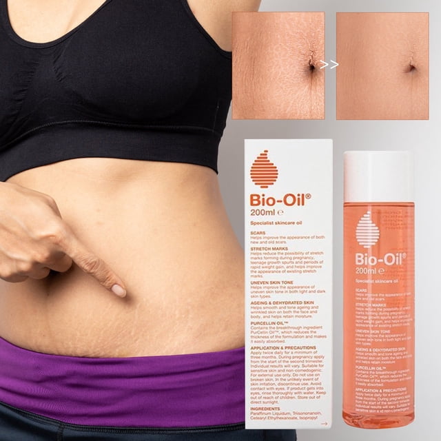 Fades Stretch Marks And Special Skin Care Oil For Pregnant Women 200ML