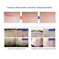 thumbnail image 4 of Maytalsory 3.5x12cm Silicone Removal Patch Reusable Remove Sticker Invisible Skin Care Tape Repair Beauty 3.5x12cm 1Set, 4 of 6