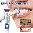 thumbnail image 3 of Toothpaste Bright White Teeth Cleaning,gochicgolden Repair And Protect Whitening Toothpaste,loose Teeth Care Toothp, 3 of 5