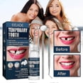 thumbnail image 2 of Kit de reparación temporal de dientes de 2 piezas que repara dientes rotos y rellena espacios, no tóxico, 2 of 5