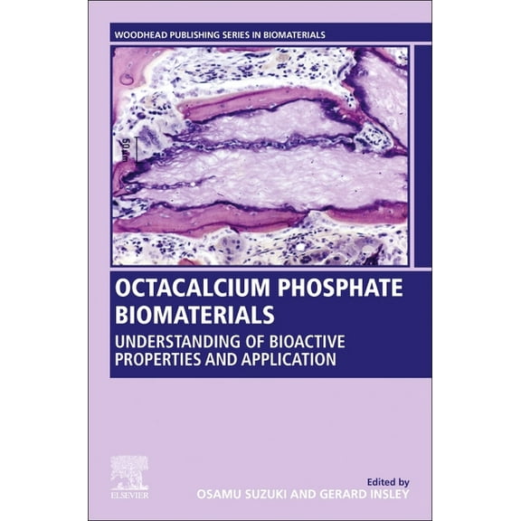 Woodhead Publishing Biomaterials Octacalcium Phosphate Biomaterials: Understanding of Bioactive Properties and Application, (Paperback)