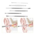 thumbnail image 3 of Stainless Steel Ear Pick Set Curette Ear Wax Remover Spiral Spring Earpick Ear Cleaner, 3 of 6