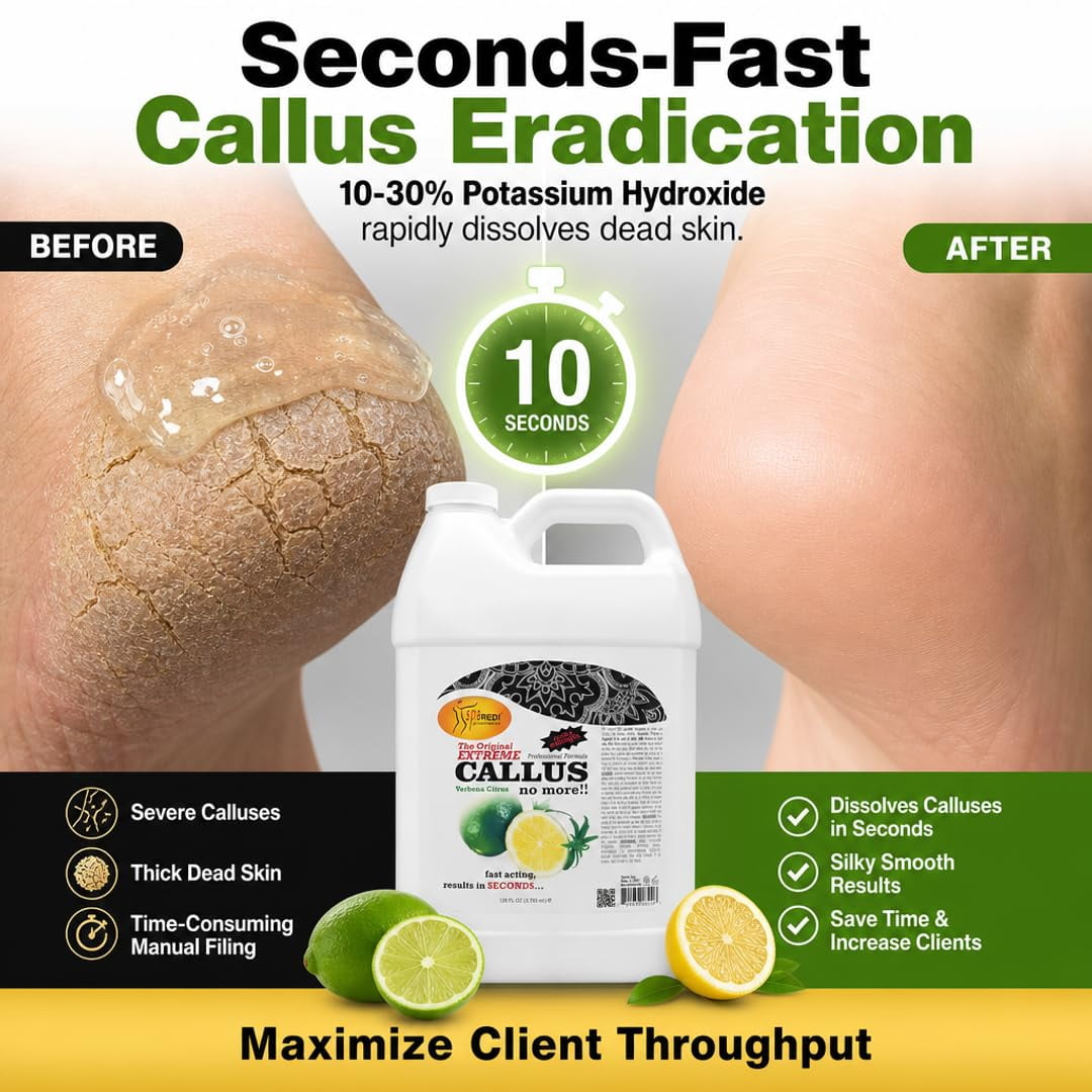 SPA REDI - Callus Remover for Feet Gel, Lemon and Lime, 128 Oz - Professional Pedicure Foot Care - Removes Toughest Calluses in Seconds and Smooths Dry Cracked Heels
