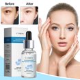 thumbnail image 1 of Glutathione Solution Improves Dull And Brightens Skin Tone, Hydrating Facial Essence（30ml）, 1 of 9