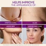 Cicatricure Cica Oil for Stretch Marks & Scars, Vitamin E Body Oil, Visible Results in 4 Weeks, 6.7 fl oz (1 Pack)