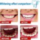 thumbnail image 3 of Press Toothpaste,baking Soda Whitening Toothpaste,jaysuing Stain Removal Whitening Toothpaste Strong Cleaning Power Natural Stain Remover Fluoride-fre, 3 of 5