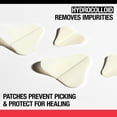 thumbnail image 4 of Parches Para acné y espinillas Neutrogena Stubborn 10 parches, 4 of 5