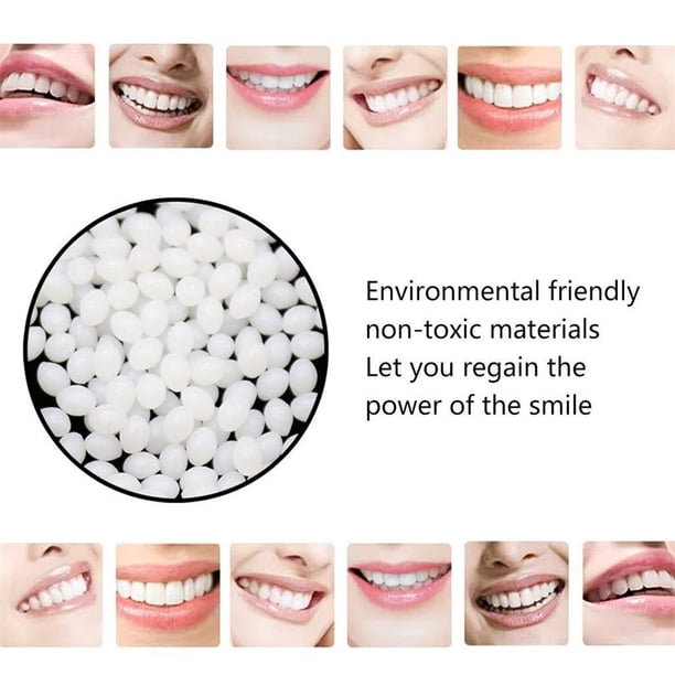 Perlas térmicas para relleno de dientes mordedores para reparar temporalmente los dientes faltantes y rotos