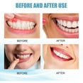 thumbnail image 4 of Toothpaste, 2pcs Brighthen Teeth Toothpaste  for Oral Hygiene, 4 of 8