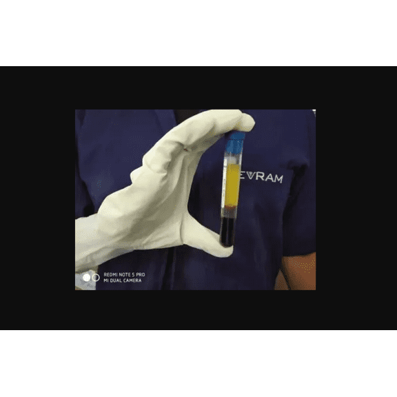 PRP Tube ACD Solution A and Gel and Hyaluronic Acid 8 mL Draw Volume 10 Tubes