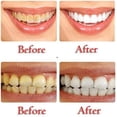 thumbnail image 5 of Pasta de dientes de 2 uds, blanqueamiento dental con carbón activado, sabor a menta fresca que elimina el mal aliento y las manchas de los dientes, 5 of 5