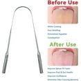 thumbnail image 5 of Mitimi Tongue Scraper with Case - 2 Pack, Fights Bad Breath, 100% Stainless Steel, 5 of 6