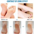 thumbnail image 2 of Foot Callus Remover Electric Foot File Professional Portable Foot Callus Remover Electronic Foot File Pedicure Tools for Hard Cracked Dry Skin, 2 of 8