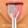 thumbnail image 3 of RAGUPEL Stainless-Steel Tongue Scraper Metal Tongue Cleaner Dental Care, 3 of 4