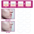 thumbnail image 4 of s,s invisibles facial,s puntos s cara, transparente Tag Girl Dry,cara fuerte impermeable,cuidado de la piel marcas cara Baoblaze parches, 4 of 8