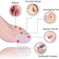 thumbnail image 2 of Toe Protectors Big Toe Protector (10 Pcs) Gel Toe Caps Protection New Material Breathable Toe Sleeves Toe Cushion Tubes Silicone Toe Covers Reli, 2 of 5