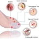 thumbnail image 2 of Toe Protectors Big Toe Protector (10 Pcs) Gel Toe Caps Protection New Material Breathable Toe Sleeves Toe Cushion Tubes Silicone Toe Covers Reli, 2 of 5