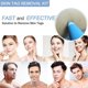 thumbnail image 5 of Remove Skin Tag Pen Facial Care Nevus Tool 2mm-4mm Remove Meat Nevus Corns Warts Skin Tag Removal Tool, 5 of 5