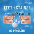 thumbnail image 4 of Kit de blanqueamiento dental MySmile con luz LED 3 x 35% Gel, 4 of 5