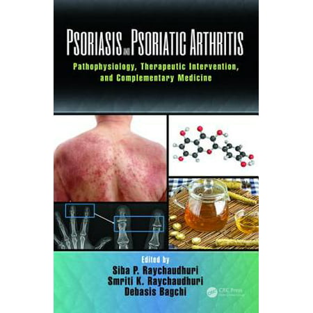 Psoriasis and Psoriatic Arthritis : Pathophysiology, Therapeutic Intervention, and Complementary