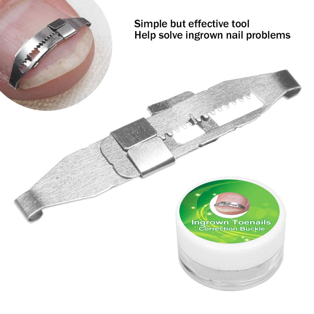 LYUMO Ingrowing Nail Corrector, Ingrown Toenail Correction Tool, Stainless Steel Ingrown Toenail Corrector Pain Relief Paronychia Treatment Correcting Tool