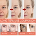 thumbnail image 3 of Squalane Rose Oil For Face Organic Squalane Facial Oils For Face Aging Reduce & Fine Lines Travel Sunblock Extractor Vacuum Face Pack for Glowing Skin Demar3 Reverse Flash Natural Face, 3 of 8