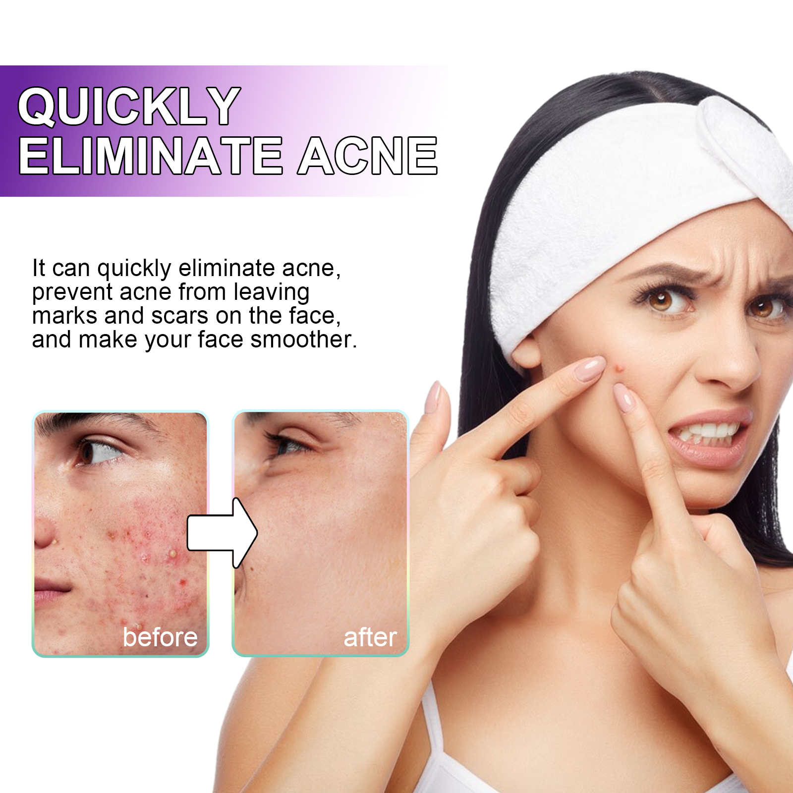 Alvantor Acne Patches Salicylic Acid Pimple Patches for Face Day/Overnight Hydrocolloid Zit Stickers Invisible Spot Treatment, 180pcs