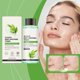 thumbnail image 4 of Aceite Tónico Salicílico 100 Ml | Reduce Los Poros | Loción Hidratante y Refinadora | Fórmula Que Controla La Grasa y Calma La Piel, 4 of 7