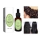 thumbnail image 3 of XWSHYW Productos para El Cuidado Del Cabello El Aceite Esencial para El Cuidado Del Cabello Mejora La Textura y El Brillo Del Cabello 30 Ml, 3 of 6