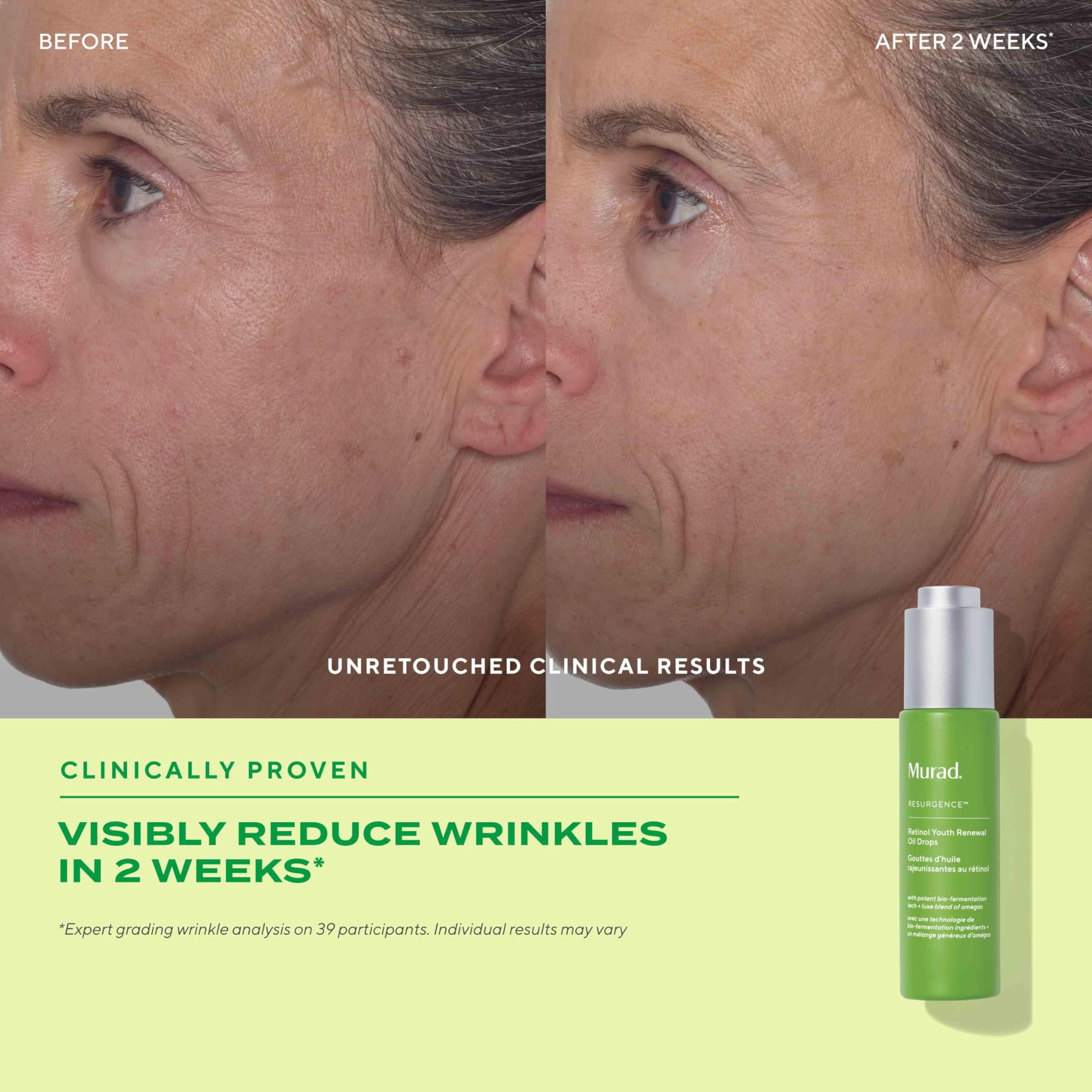Murad Retinol Youth Renewal Oil Drops - Anti-Aging Facial Oil, Hydrates, Smooths Fine Lines & Wrinkles - 1.0 oz