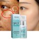 thumbnail image 2 of Crema Facial para eliminar puntos negros, crema hidratante para eliminar melanina, blanqueadora, pecas, producto para el cuidado de la piel Facial Fivean unisex, 2 of 2