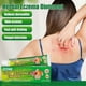 thumbnail image 4 of Antifungal Cream 20g - Anti Fungal Skin Cream Relief Jock Itch, Ringworm, Eczema, Antifungal Cream Fast Soothe Fungal Skin for Face & Body,Hebal Anti-, 4 of 5