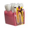 thumbnail image 2 of Modelo de caries dental 6 veces Estructura de automóvil de resina 315x217x335 Herramienta de aprendizaje educativo compacto para la demostración de au, 2 of 9