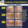 thumbnail image 4 of Gel aclarador de uñas con hongos NONYX, 120 ml, mejora al 90% las uñas de los pies, 4 of 5