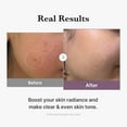 thumbnail image 5 of medicube Age-R Glutathione Glow Milky Toner, Low-Irritation Double Layer Toner for Glass Glow Skin with Peptide, Even Skin Tone, Radiance, Hydration, Korean Skincare, 5 of 7