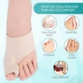 thumbnail image 3 of Pinkiou Bunion Corrector Sleeve Brace Toe Separator Spacer Cushion Pads 2pcs (Size L), 3 of 10