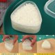 thumbnail image 3 of 7 piezas Kit para hacer sushi con forma de triángulo y corazón redondo: herramientas de cocina para niños YGWL, 3 of 5